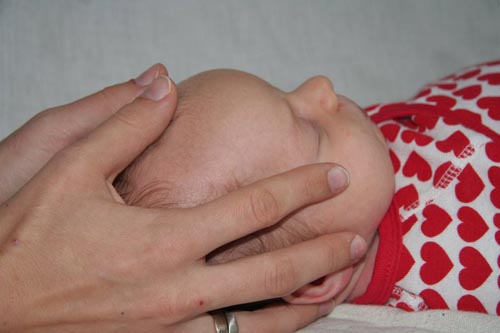 Cranio bei Kleinkind